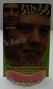 Billy-Bob Braces